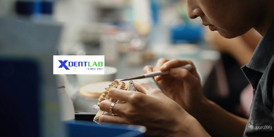 Dental Labs in Vietnam District 4 Ho Chi Minh City