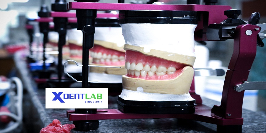 Dental Labs in vietnam District 7 Ho Chi Minh 